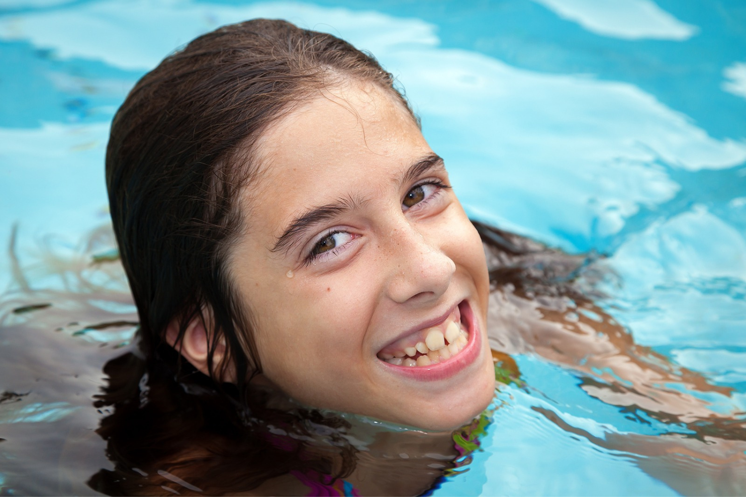 Do I need braces if my teeth are only slightly crooked?